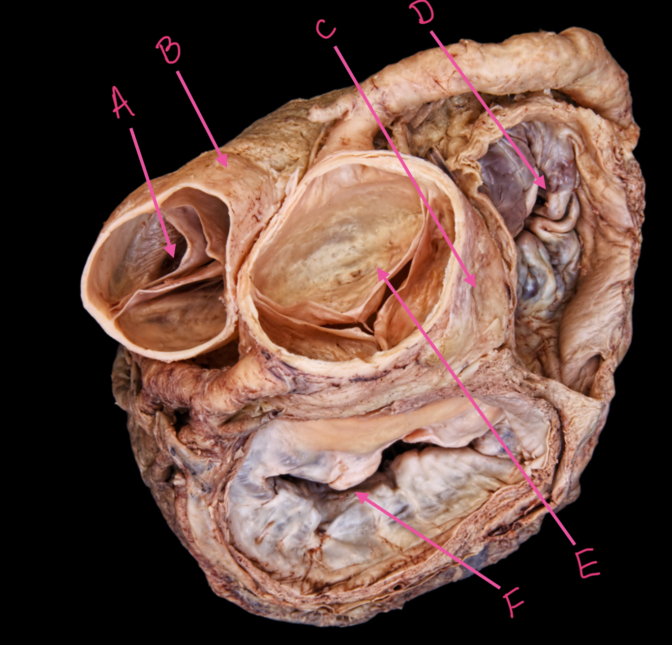 term image