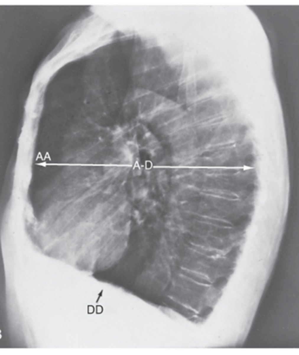 <p>Interpretation?</p>