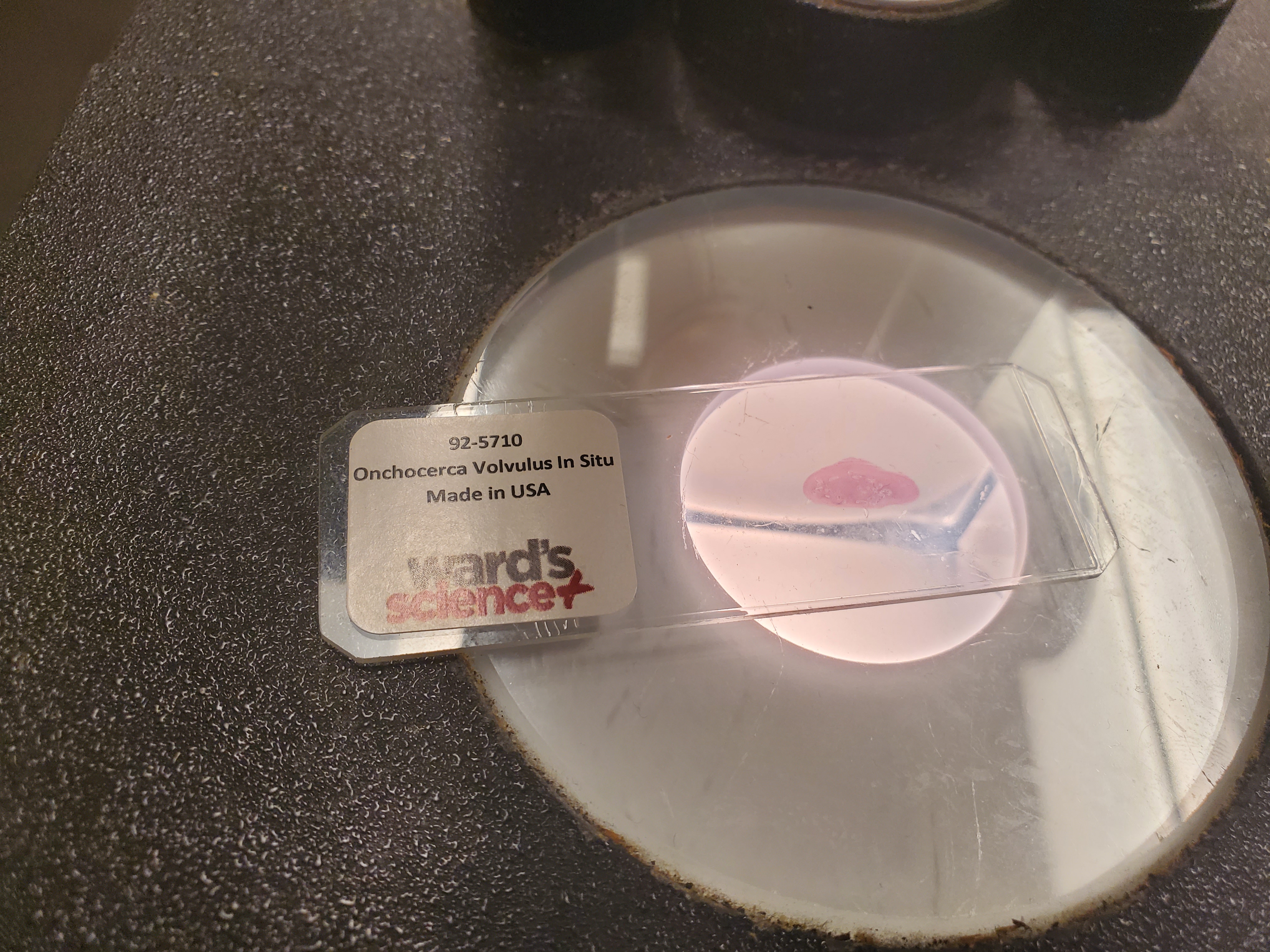 <p>Onchocerca Volvulus</p>