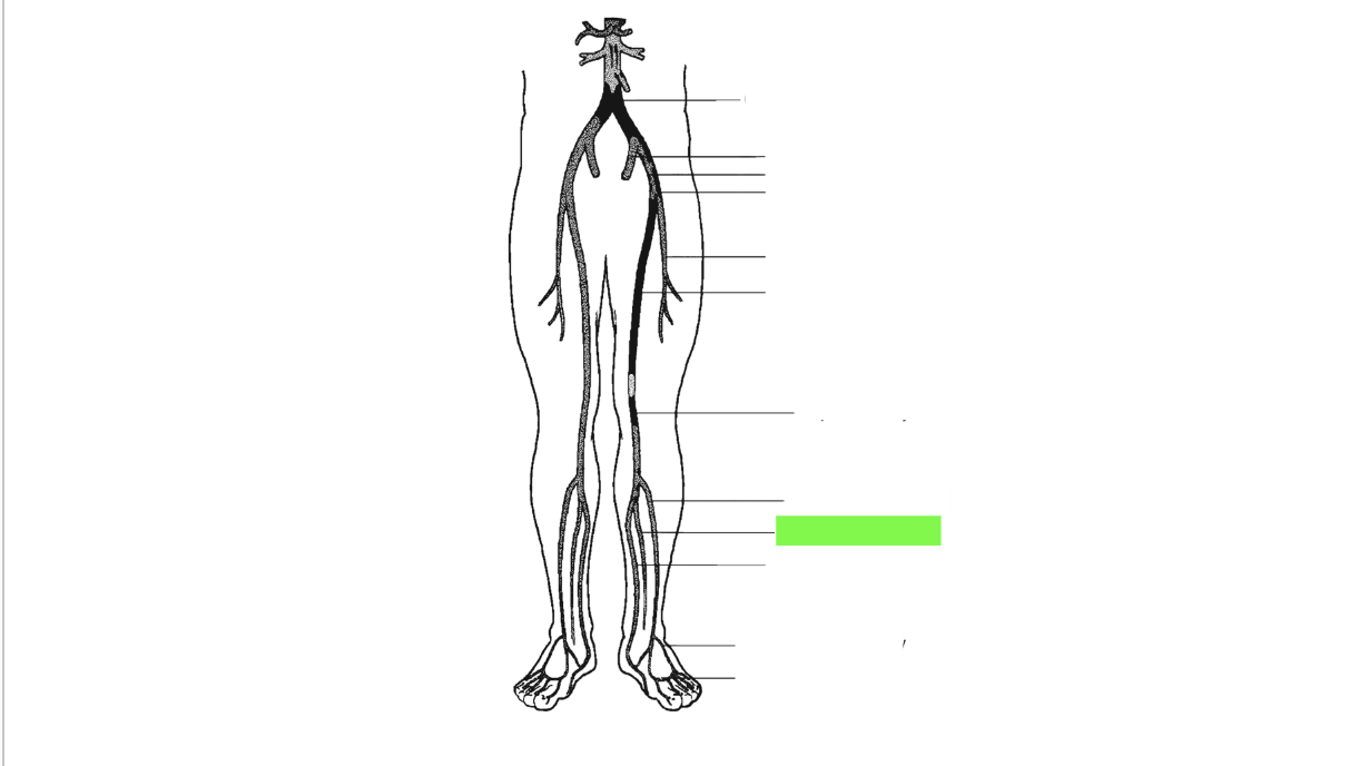 <p>What artery is this </p>