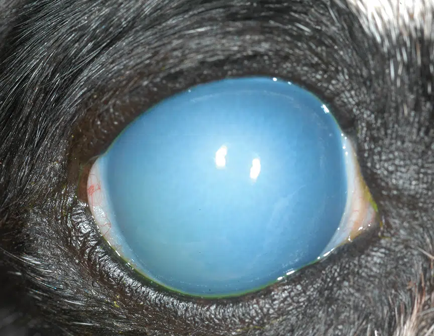 <p>Uveitis, corneal opacity ("blue eye"), and severe eye pain often disproportionate to clinical findings</p>