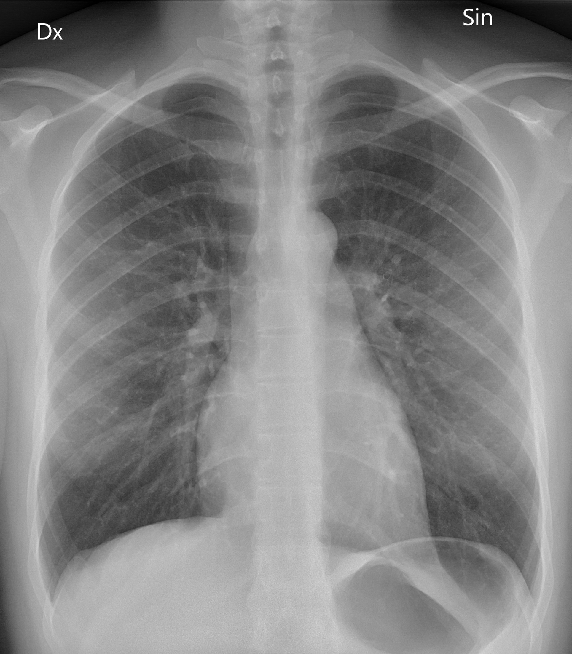 <p>The actual image produced on film or a digital receptor by X-rays.</p>