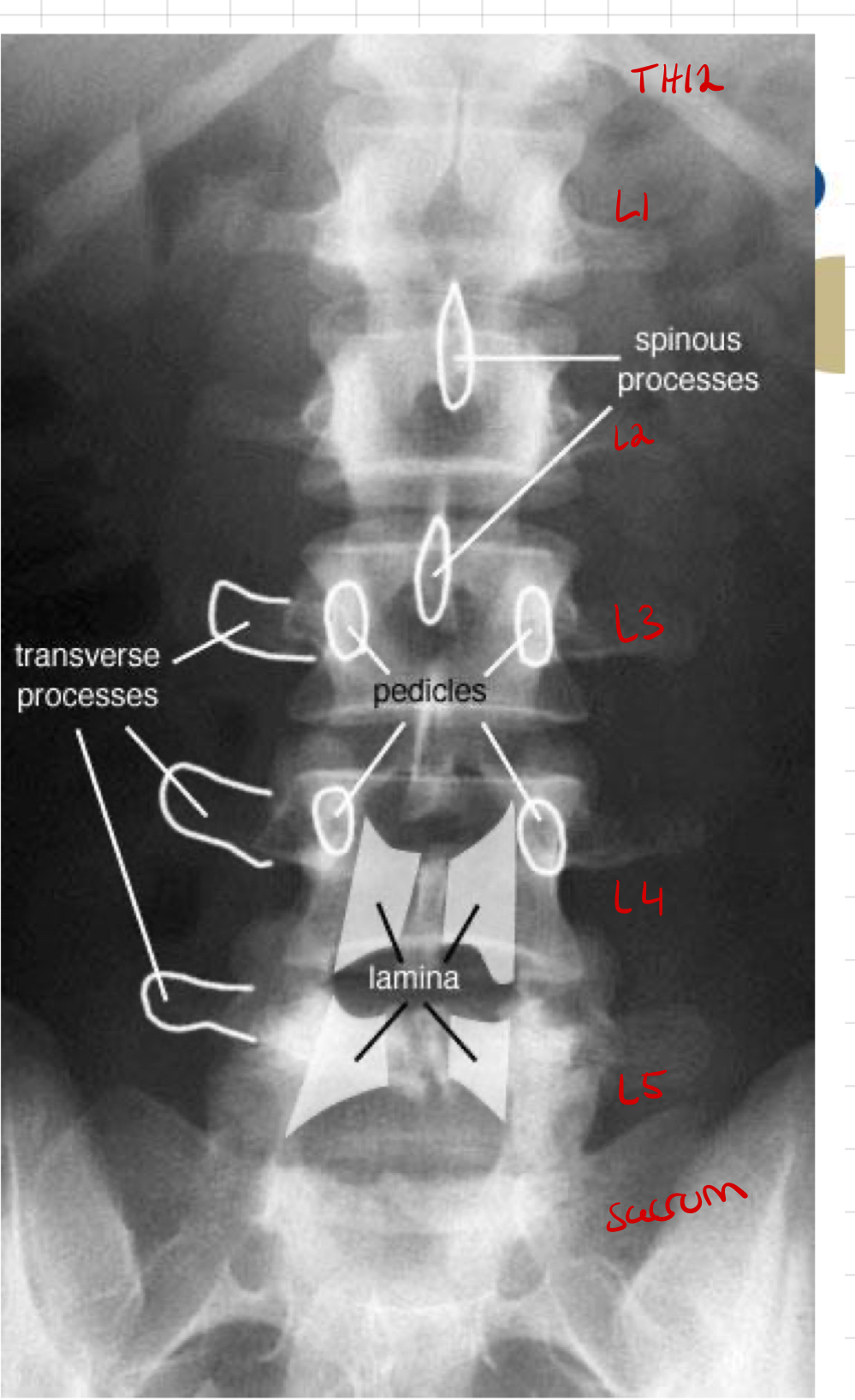 <ul><li><p>T12 tom. S1 </p></li><li><p>Corpus vertebrae, processus transversus, spinosus og pediclere skal være synlige. </p></li><li><p>Ingen rotasjon av pasienten - ileosacralleddene er like langt fra processus spinosusene. Spinosusene i midtlinjen. </p></li><li><p>Åpne intervertebralledd - delvis fleksjon av knærne retter ut lordosen og gir åpne leddspalter i bildet. </p></li></ul>