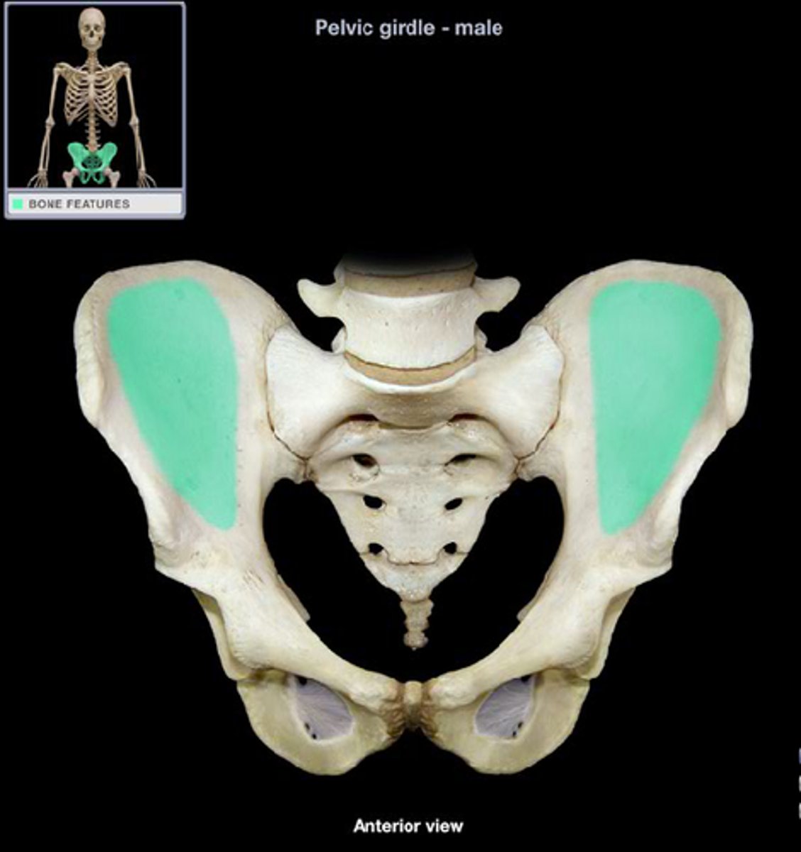 <p>a depression on the medial side of the fan-shaped portion of the ilium</p>