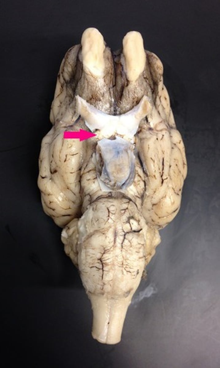 <p>Identify the structure.</p>