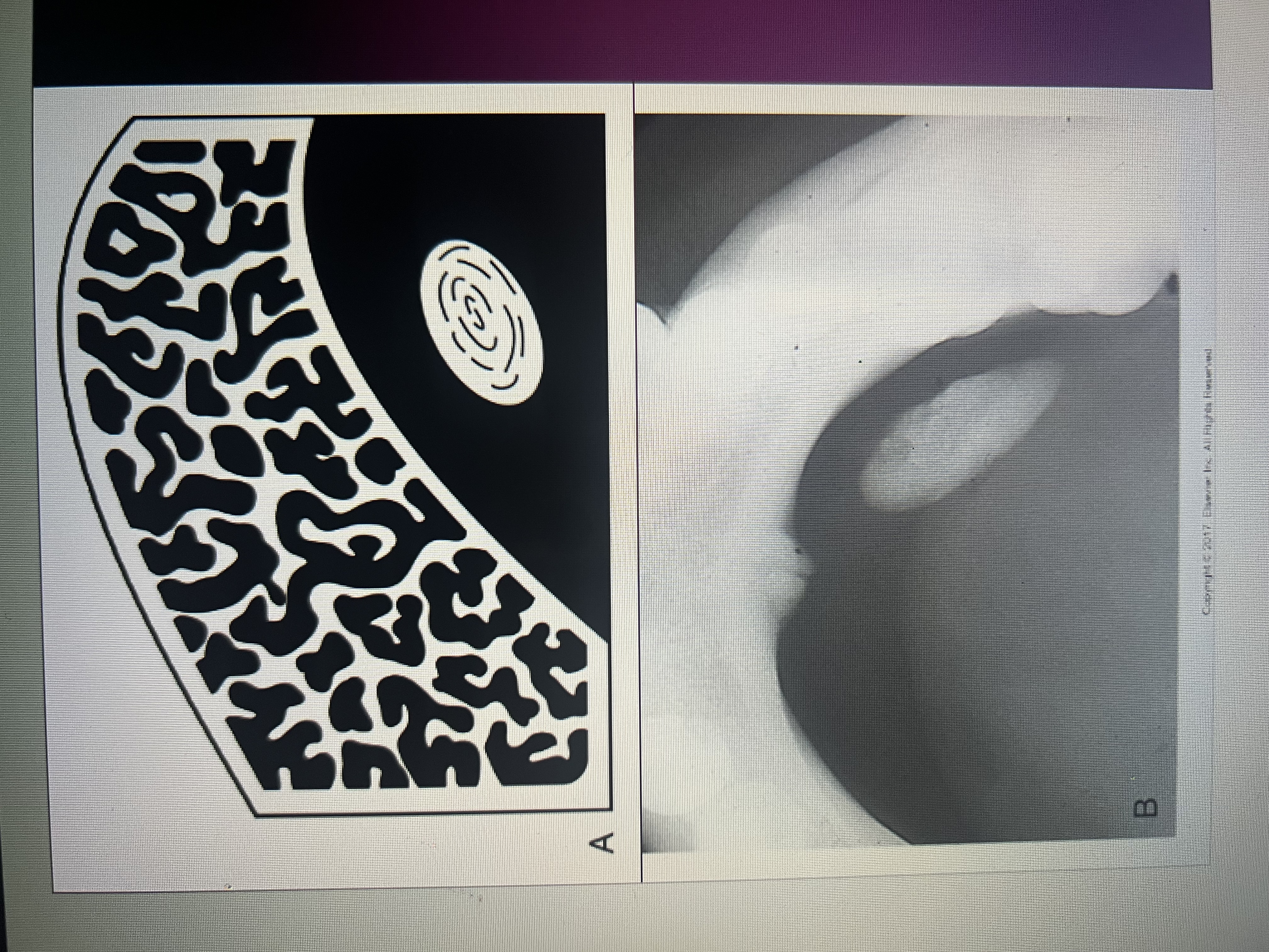 <p>Well defined radiopaque area located in soft tissue.</p>