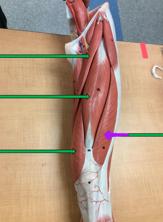 <p>Identify this muscle?</p>