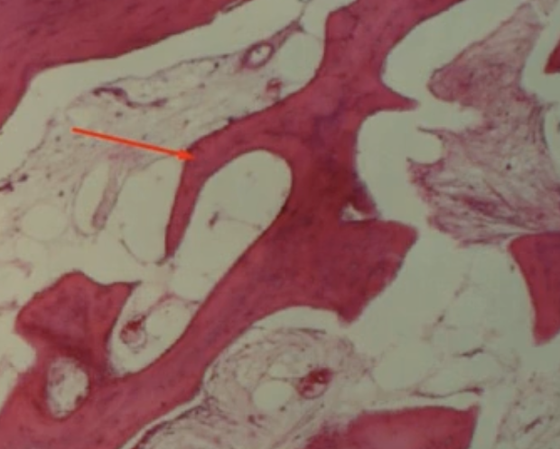 <p>What are the red arrows of spongey bone pointing to?</p>