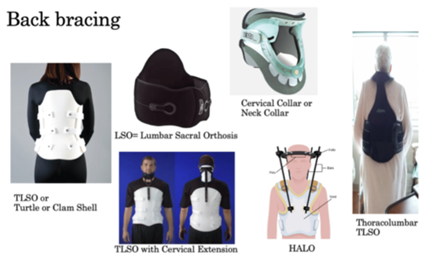 <p>-Turtle or clam shell (TLSO)<br>-Lumbar sacral orthosis (LSO)<br>-Cervical collar or neck collar<br>-TLSO with cervical extension<br>-HALO<br>-Thoracolumbar (TLSO)</p>