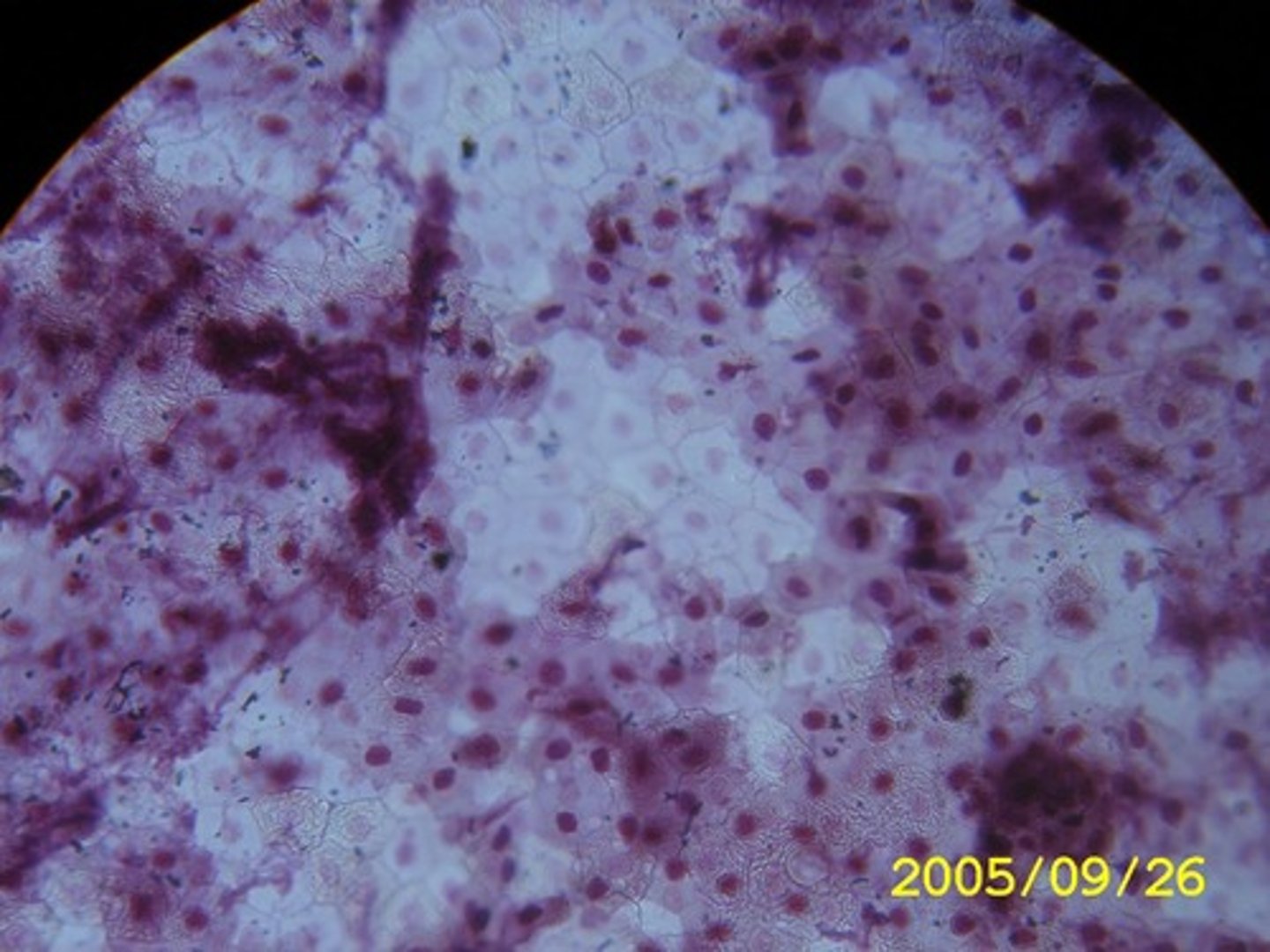 <p>Function - Allows materials to pass by diffusion and filtration in sites where protection is not important.</p><p>Secretes lubricating substances in serosae.</p><p>Location - Air sacs of lungs, kidney glomeruli, lining of heart, blood vessels</p>