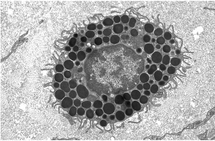 <ul><li><p>Circulate in the blood as undifferentiated cells, then enter the tissues and “implant” in a fixed location</p></li><li><p>Have cytoplasmic granules containing histamine, which are released in response to either chemical signals or physical stimulation (nerve signals)</p></li><li><p>Cause anaphylaxis, itchiness, hives, etc.</p></li><li><p>Also aid in wound healing and other processes</p></li><li><p><strong>Morphology</strong>: mononuclear, very high concentrations of granules, pseudopods (sensory, not phagocytic)</p></li></ul><p></p>
