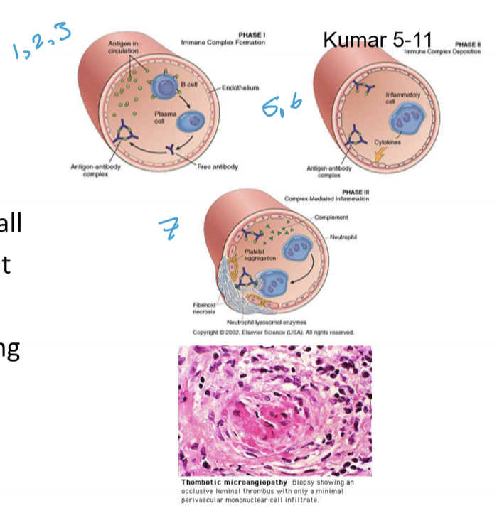 <ol><li><p>sensitization</p></li><li><p>antibodies produced</p></li><li><p>circulating immune complex forms and deposits on vessel wall </p></li><li><p>activates PMNs and compliment </p></li><li><p>intimal inflammation/damage</p></li><li><p>blood seeps out of vessel, causing petechiae </p></li></ol><p></p>