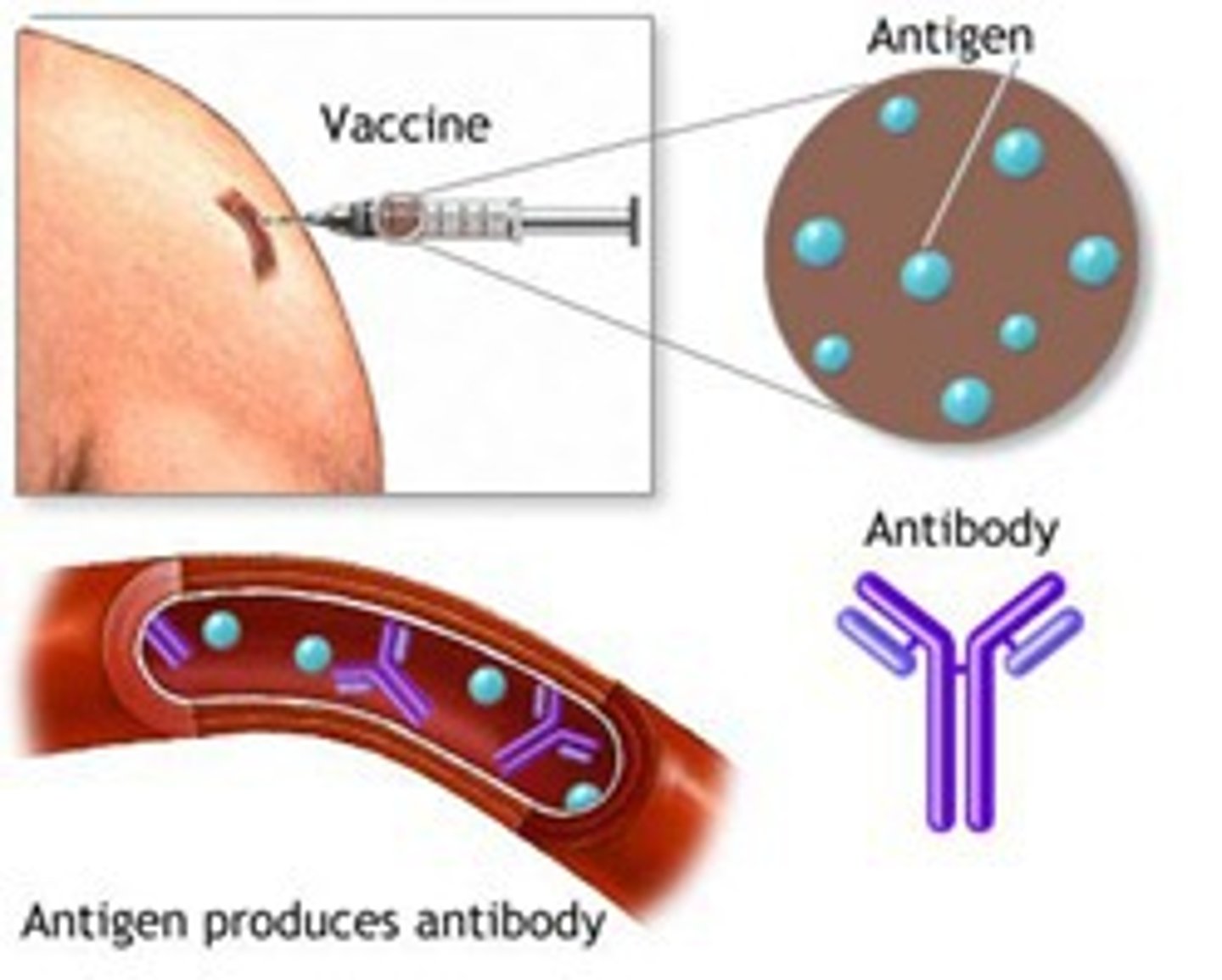 <p>Immunization is the process by which an individual is made immune or resistant to an infectious disease, typically by the administration of a vaccine.</p>