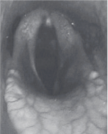 <p>Dixon Grade?</p>