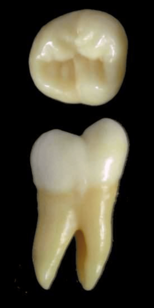 <p>what tooth is this &amp; why?</p>