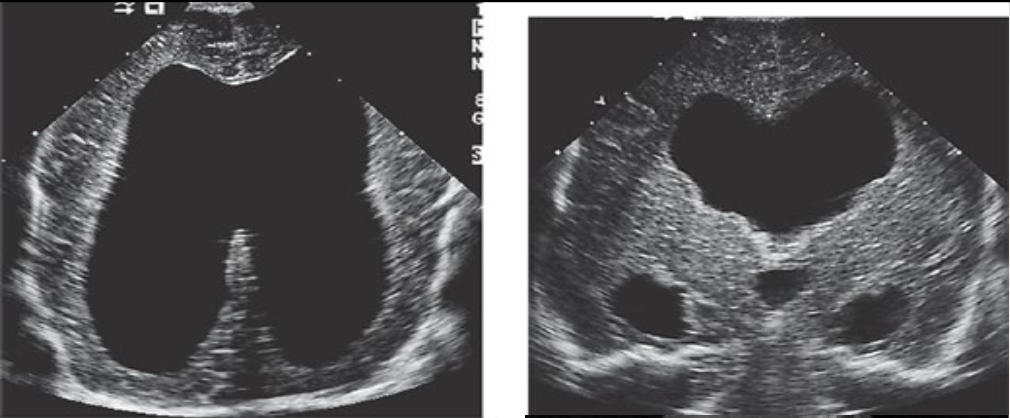 <p>What pathology is being shown?</p>