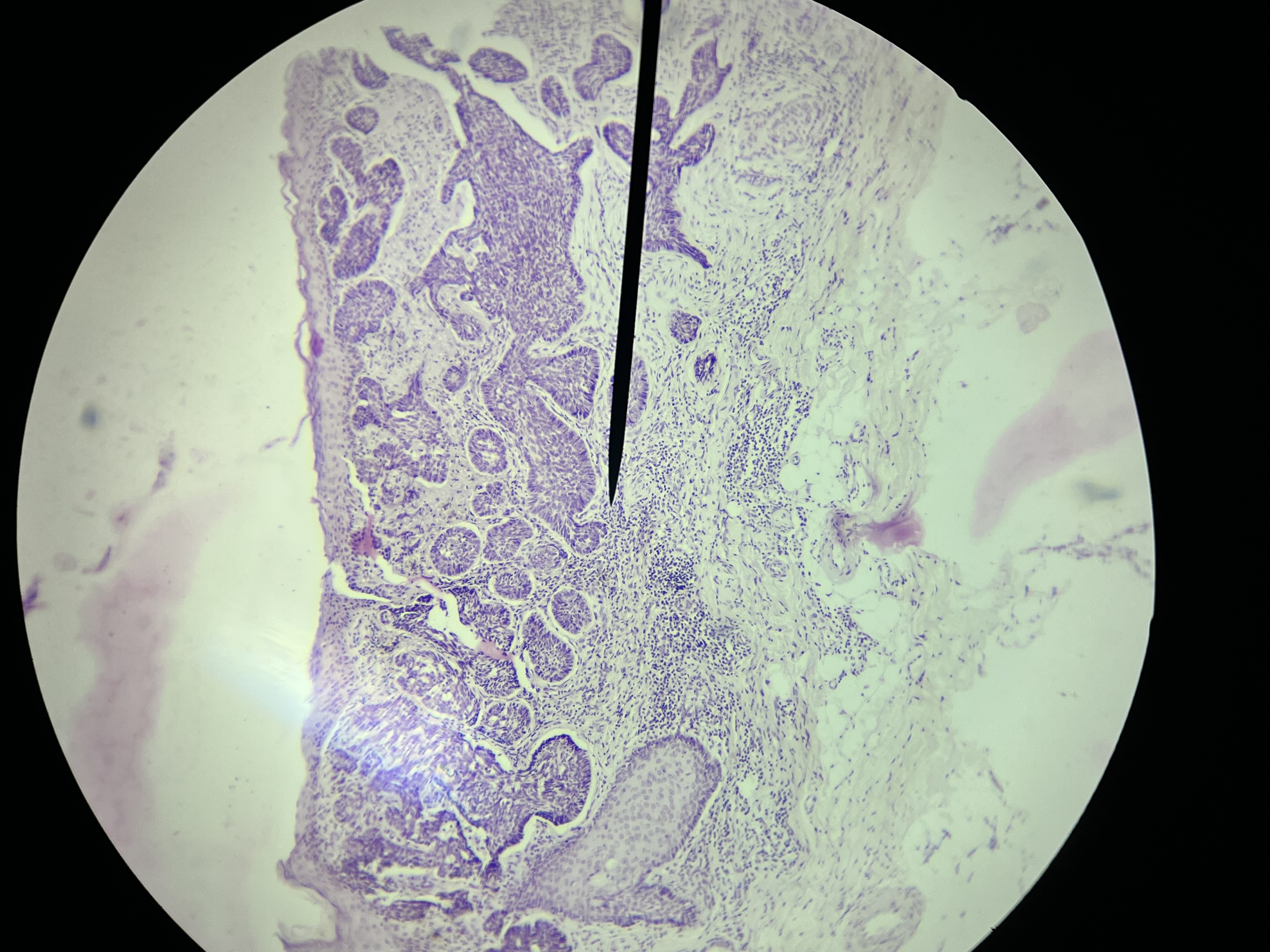 <p>What is the diagnosis?</p>