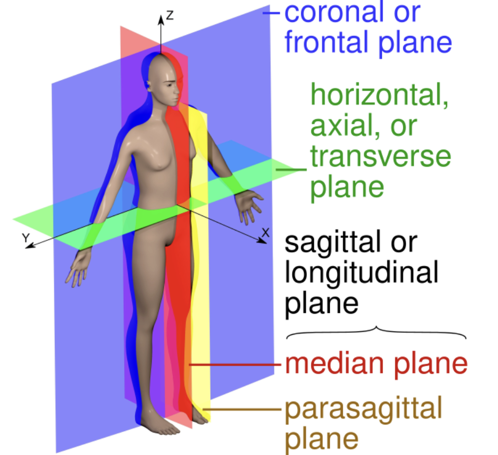 <p>vertical cut that is located to the left or right of the body’s midline</p>