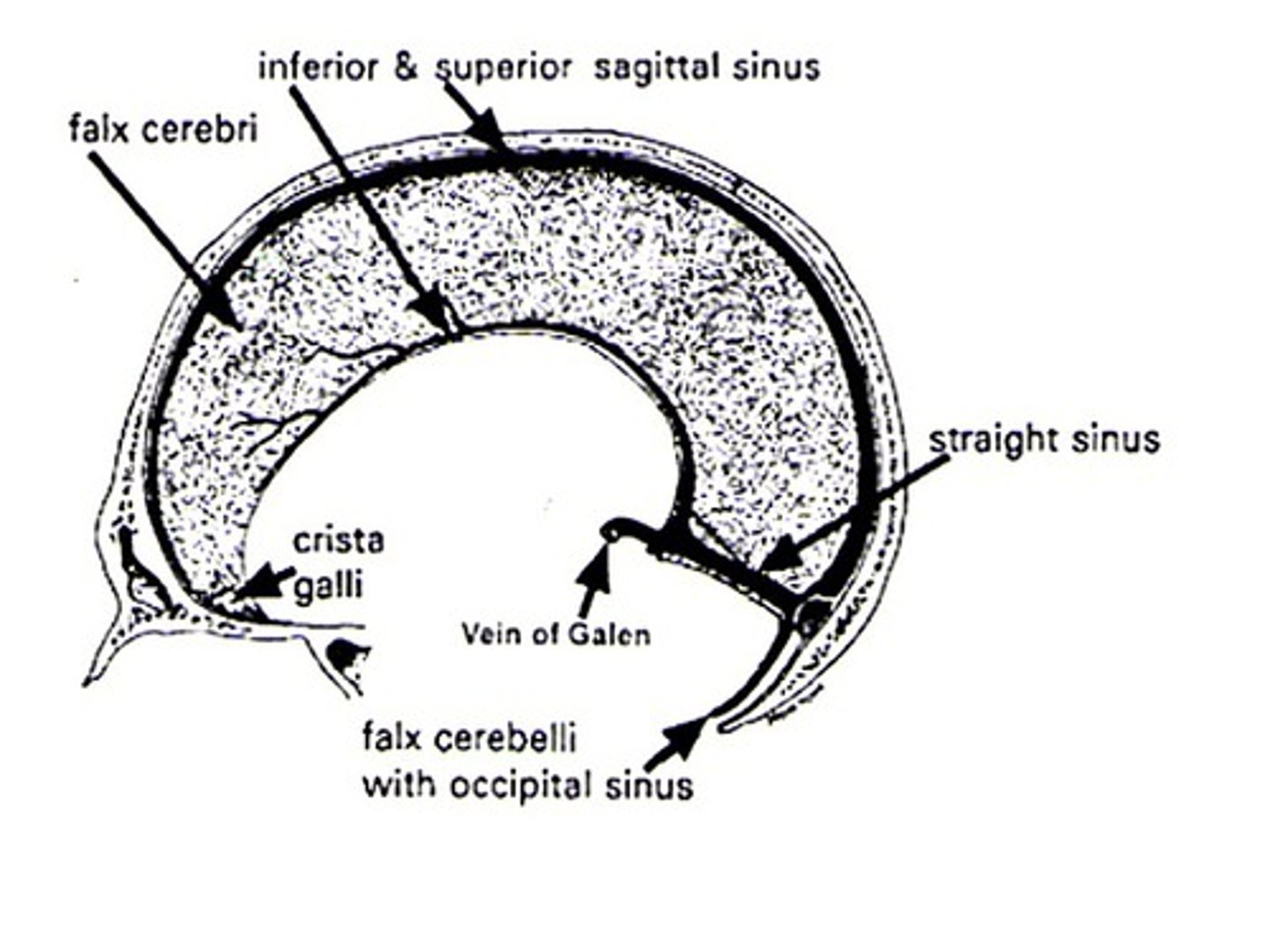 <p>superior and inferiorer sagittal sinuses</p>