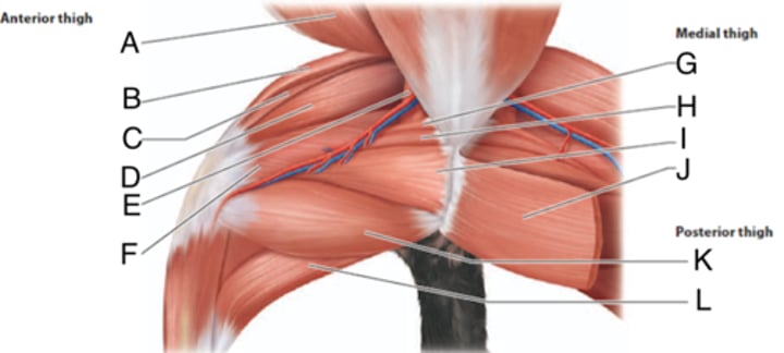 <p>What is the muscle indicated by letter L?</p>