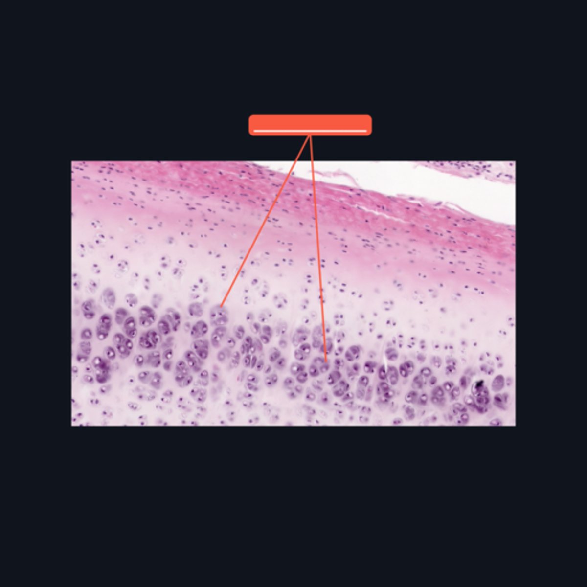 <p>What do you call the intercellular substance that immediately surrounds the lacuna? This area is intensely basophilic because it is particularly rich in ___________.</p>