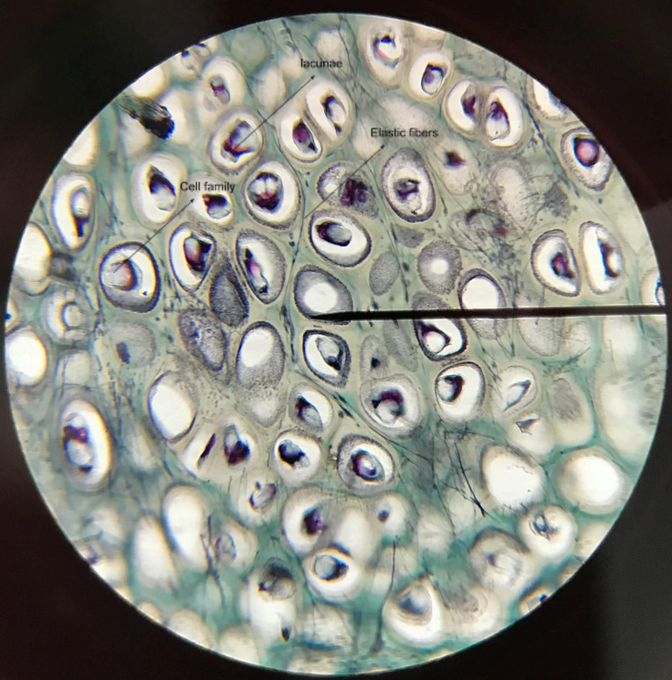 <p>similar to hyaline cartilage; lacunae are scattered in isogenous groups of two or four cells called <strong>cell family</strong>; difference with the hyaline cartilage is this one has elastic fibers permeating </p>