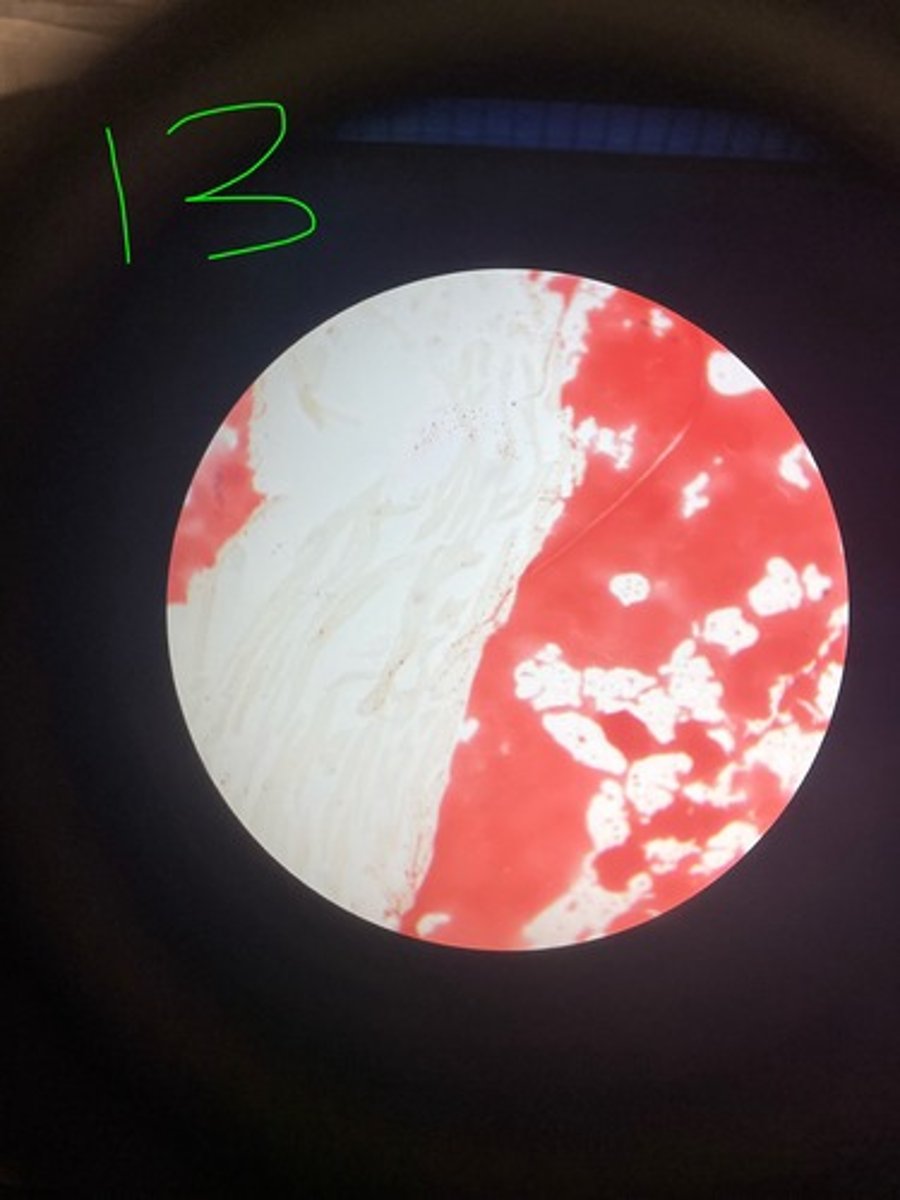 <p>What stain is this?</p>