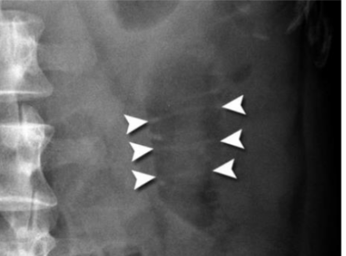 <p>What is this </p>