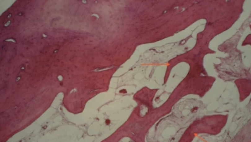 <p>What type of bone tissue does the picture depict?</p>