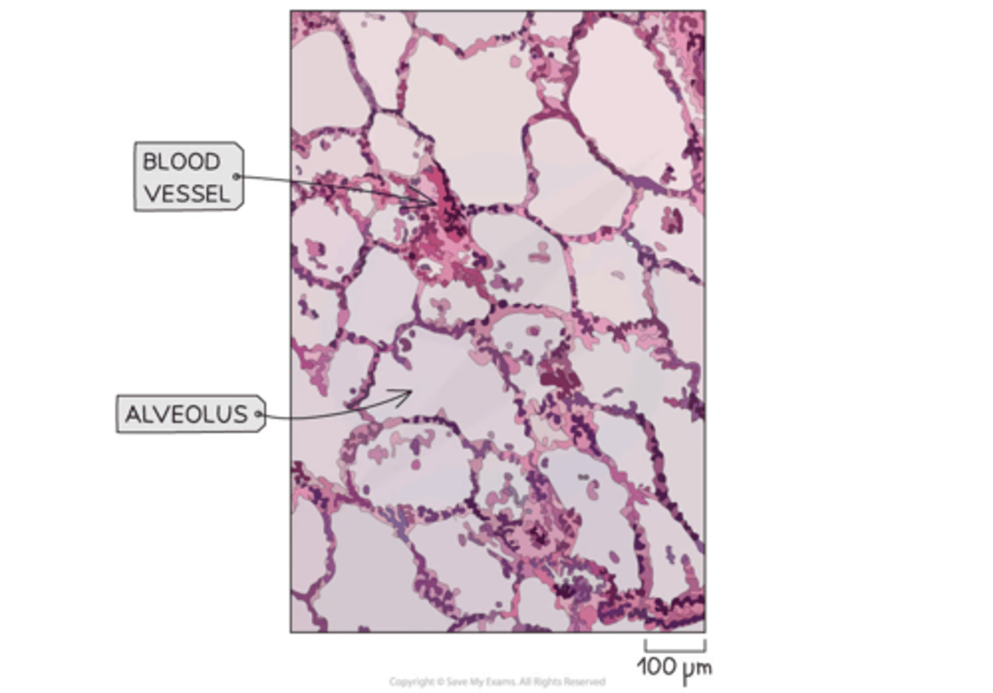 <p>-alveoli are different sizes and shapes bc no longer inflated <br>-the nuclei are shown as dark dots<br>-blood vessels can be found btw alveoli<br>-sometimes wbcs present in tissue</p>