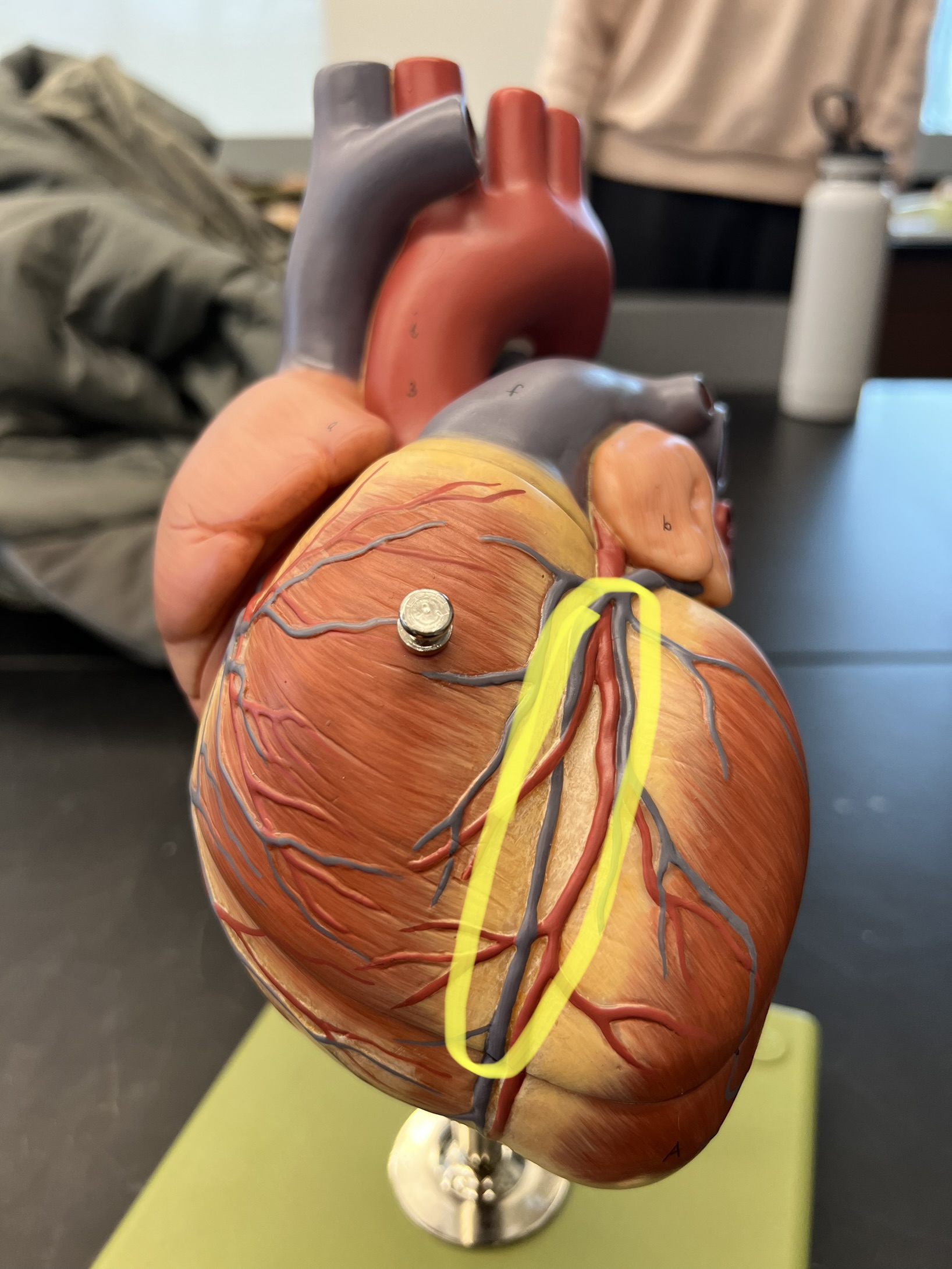 Name the heart structure.