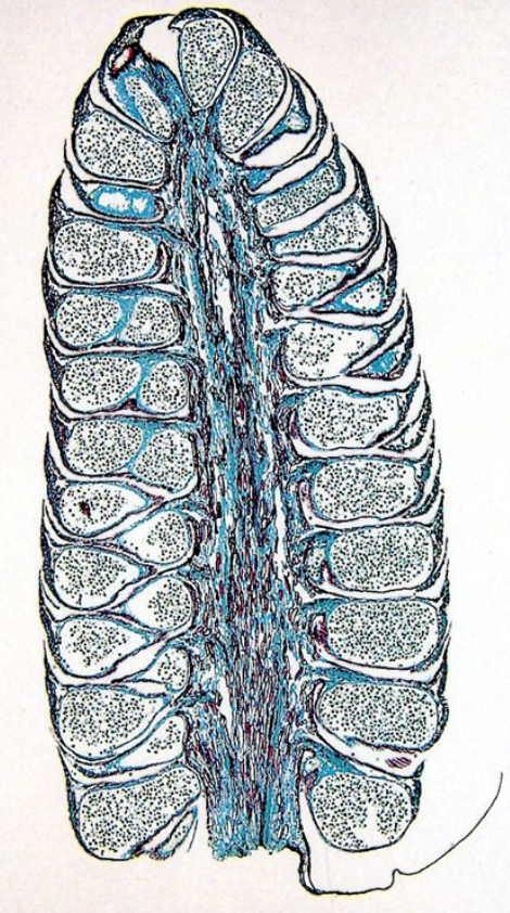 <p>Identify the following on the simple strobulis:</p><ul><li><p>Central Axis</p></li><li><p>Microsporophyll</p></li><li><p>Microsporangium</p></li><li><p>Pollen</p></li></ul><p></p>