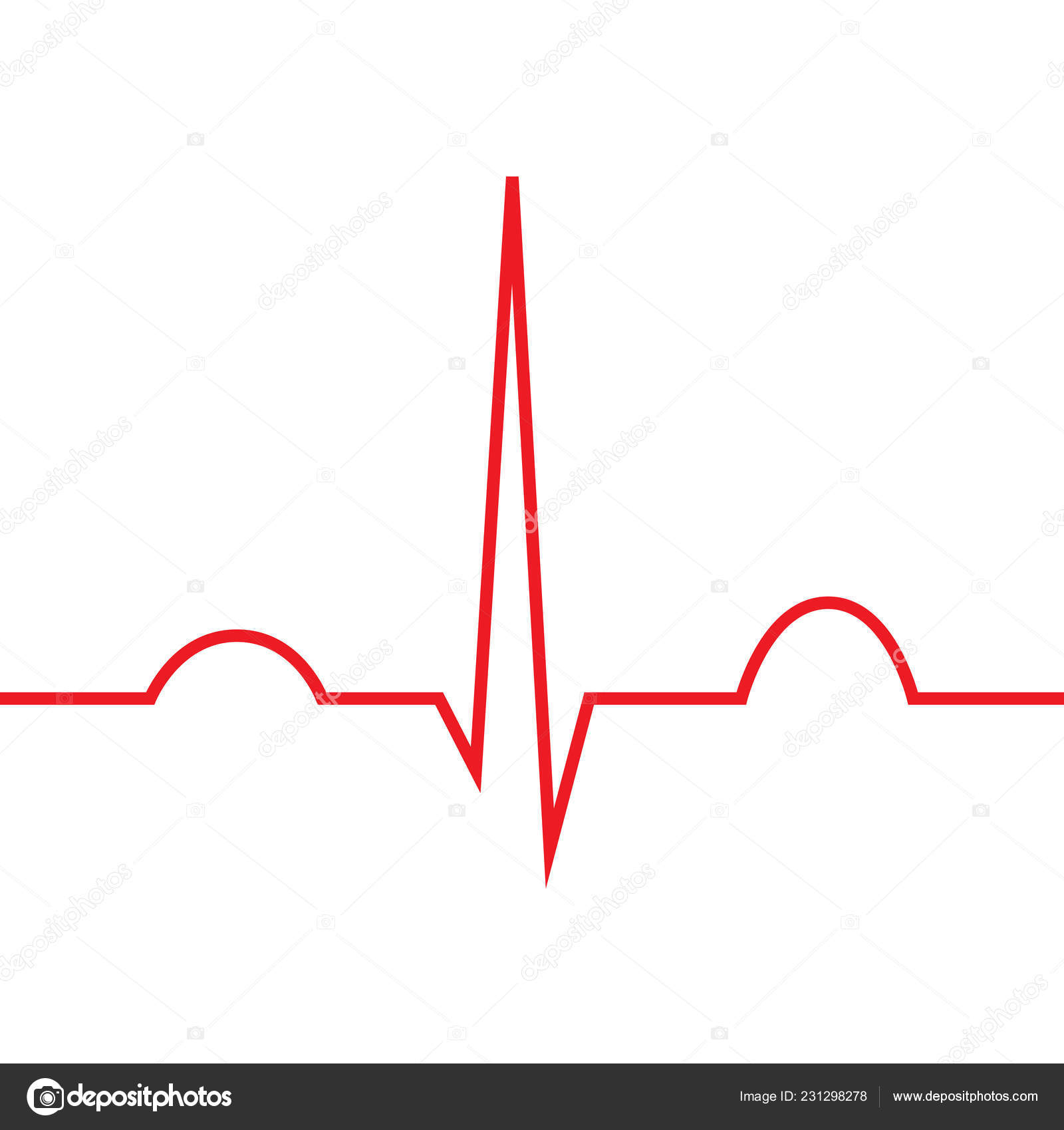 <p>Co můžeme vidět na elektrokardiogramu? Co vše se na něm posuzuje?</p>