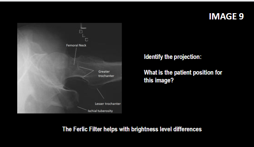 <p>what is the patient position</p>