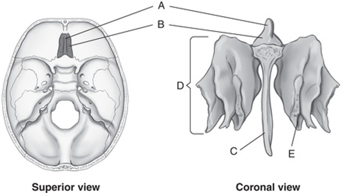 <p>A. Crista galli</p><p>B. Cribriform plate</p><p>C. Perpendicular plate</p><p>D. Lateral labyrinth (mass)</p><p>E. Middle nasal conchae (turbinate)</p>