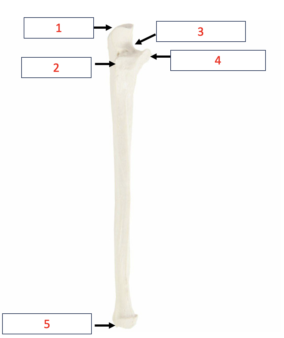 <p>Unla - radial notch&nbsp;</p>