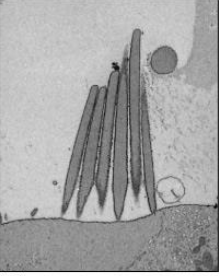 <p>transmission electron microscope, internal structures</p>