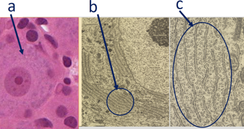 <p>Which structure(s) of the nerve cell best match(es) both the definition(s)/location and the image(s)?</p><p>a- Nissl bodies - cytoplasm for coarse aggregates of basophilic substance</p><p>b- Nissl bodies - rough endoplasmic reticulum and polyribosomes</p><p>c- mitochondria in cells that produce ATP</p><p>d- a and b</p><p>e- A, B, and C</p><p><br></p>