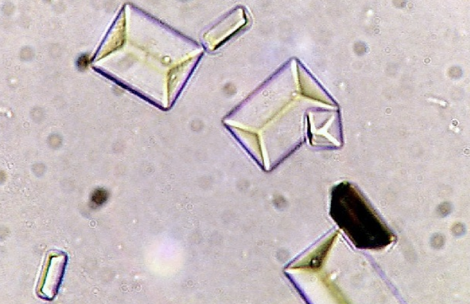 <p>What kind of crystals are shown? What kind of urine are they found in?</p>