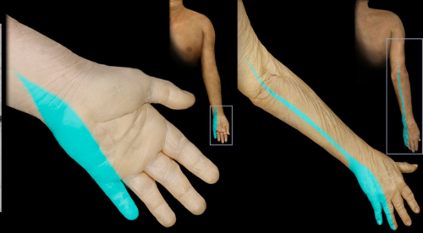 <p>Dermatome: Medial arm and forearm to long, ring, and middle fingers</p><p>Muscles innervated: Ulnar deviators, thumb EXT, thumb adductors</p><p>Reflexes (if any): None</p><p>Paresthesias: Little finger</p>