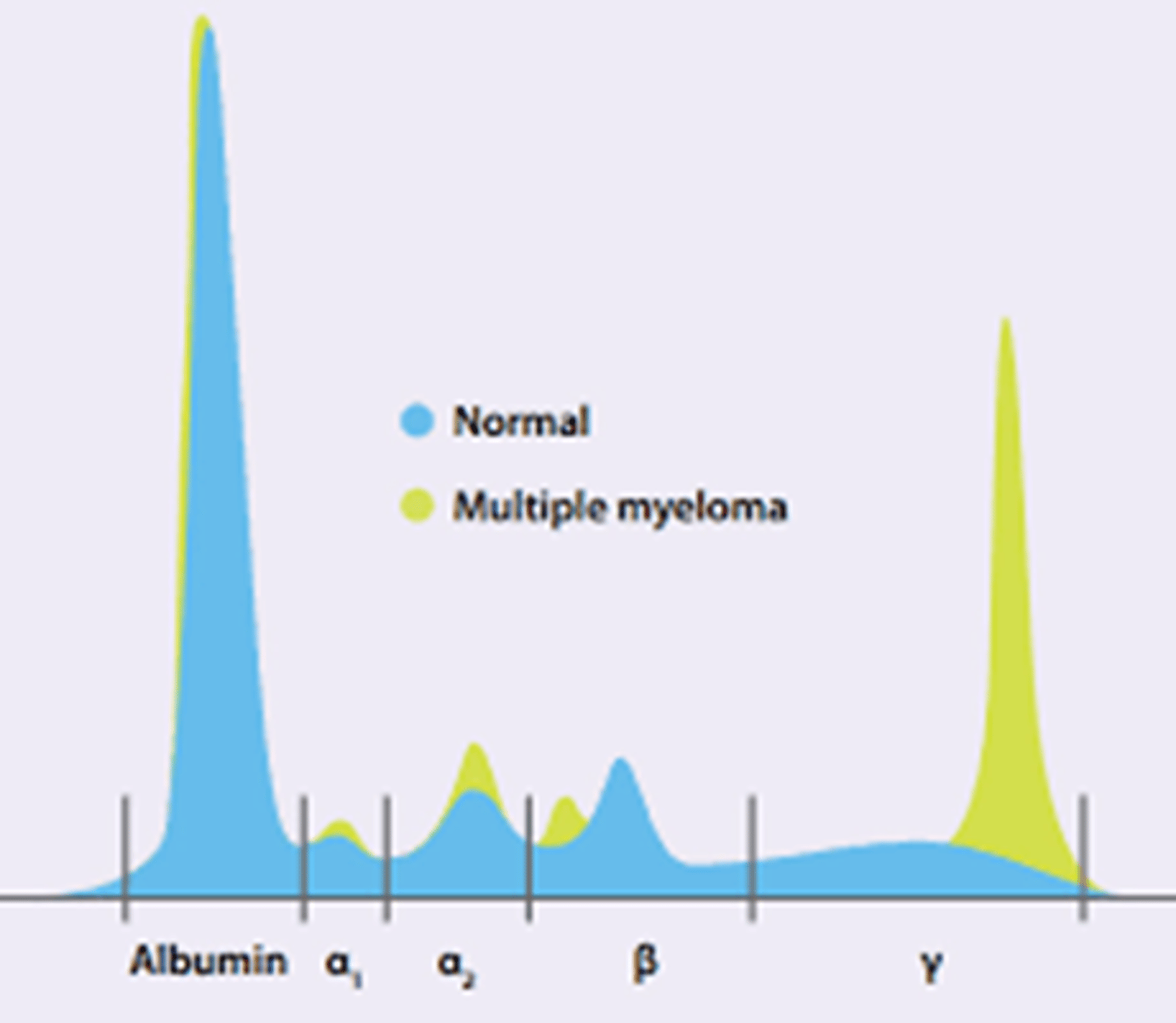 <p>-monoclonal proteins can be confirmed</p><p>-Ig, alumbin, and minor proteins</p><p>-ALBUMIN, alpha 1, 2, beta, ,gamma (where MM is)</p><p>-M SPIKE = multiple myeloma</p><p>-these monoclonal proteins have only ONE light chain (kappa or lambda) and one heavy chain (GAMED)</p><p>-can see the m spike in serum or URINE</p>