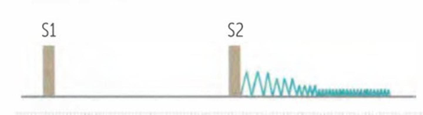 <p>- de Musset sign—head bobbing</p><p>- wide pulse pressure, > 60 mmHg</p><p>- left ventricular hypertrophy</p>