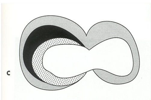 <p>What does this image show</p>