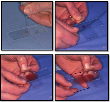 <p>Squash technique </p>