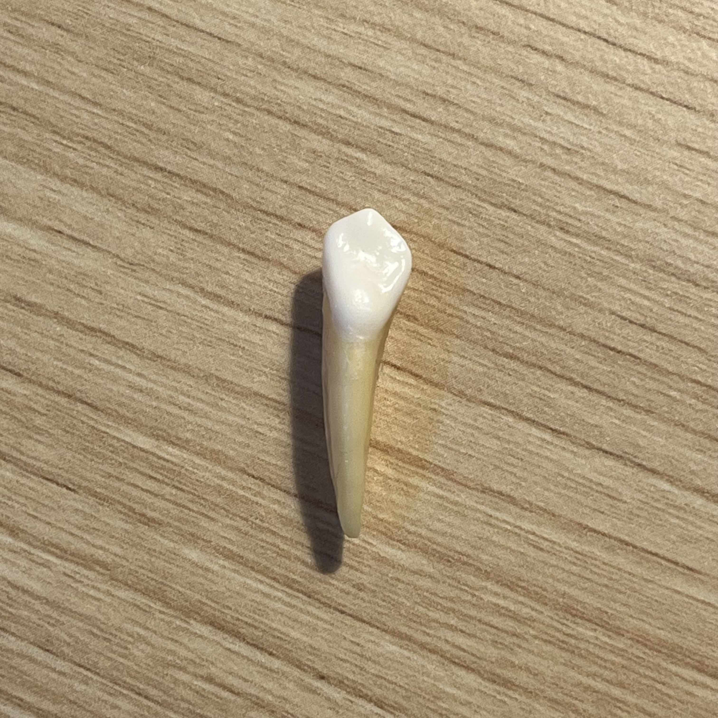 <p>What tooth is this (with view)?</p>