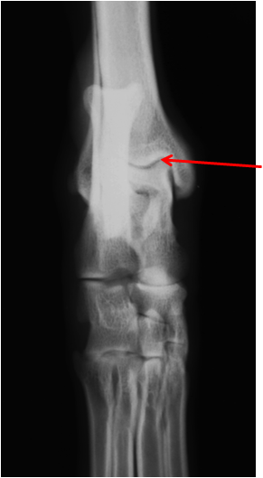 <p>identify this joint</p>