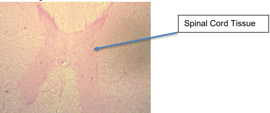 <p>Chacteristics: Branched dendrites, axon, and cell body</p><p>Function: Cell signaling between body and brain</p><p>Location: Spinal cord</p>