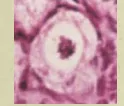 <p>Preantral | Primordial Follicle&nbsp;</p>