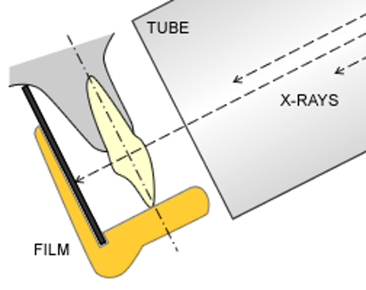 <p>1) Long axis of tooth and film are parallel to eachother<br>2) The central ray is directed perpendicular to the long axis of the tooth and film</p>