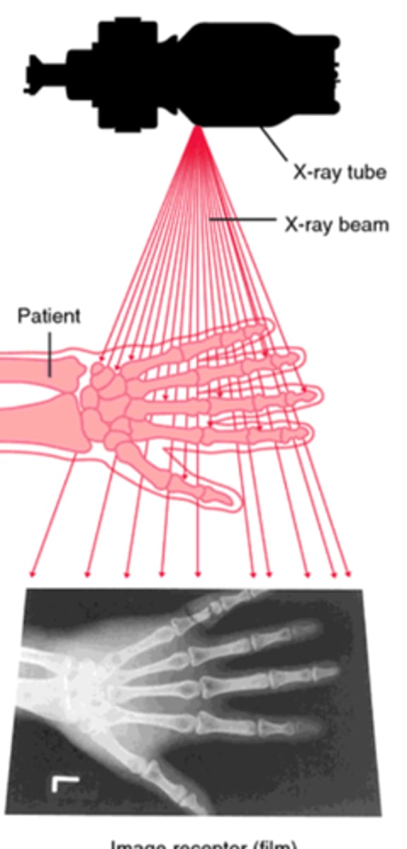 <p>Radiation coming out of patient, aka 'exit radiation'</p>